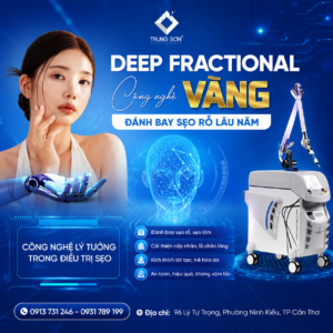 Hình ảnh công nghệ Deep Fractional tại Thẩm mỹ Trung Sơn Cần Thơ. Giải pháp hỗ trợ điều trị sẹo rỗ lâu năm, kích thích tái tạo collagen, cải thiện bề mặt da, thu nhỏ lỗ chân lông và trẻ hóa làn da an toàn, hiệu quả.