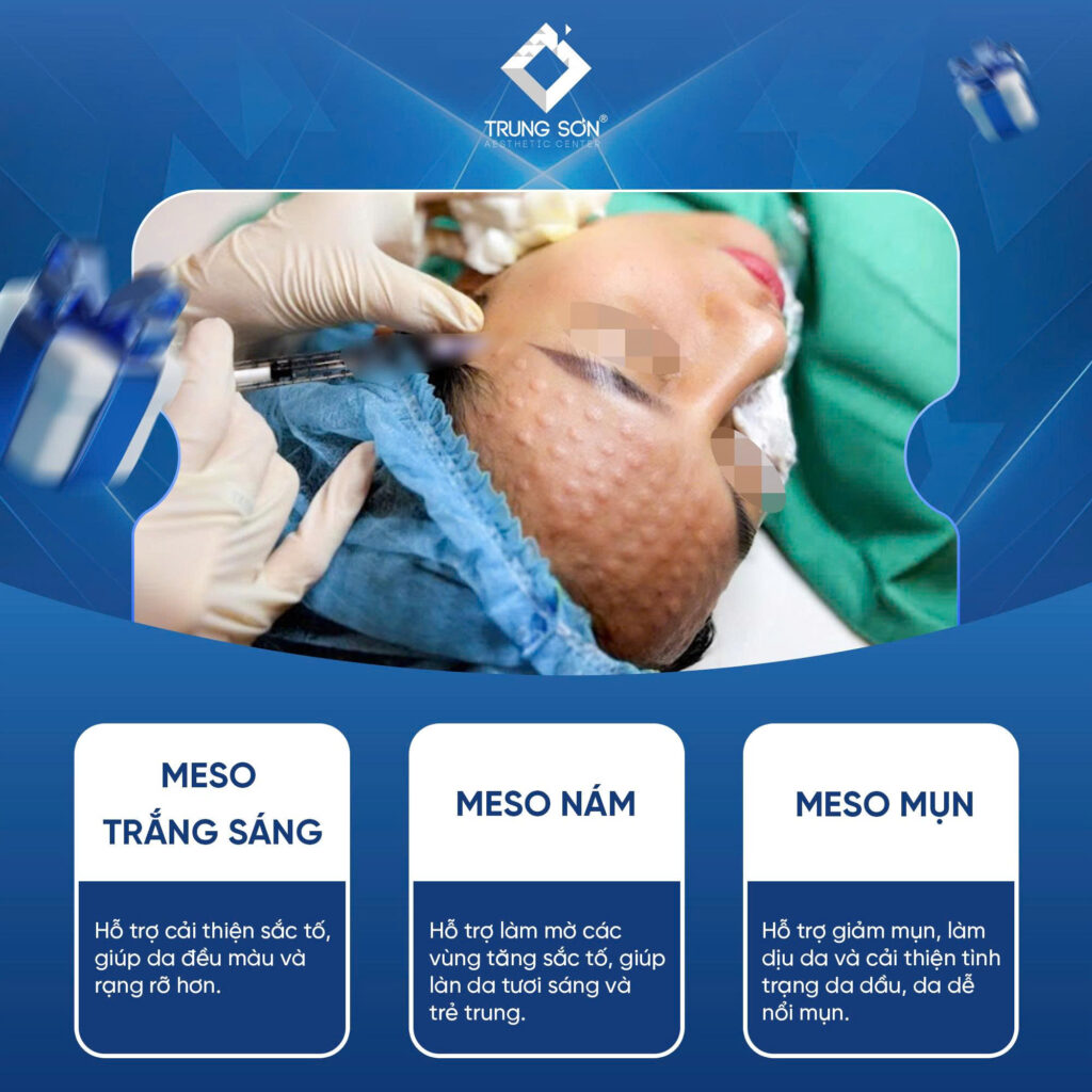 Meso trắng sáng meso nám meso mụn tại Thẩm mỹ Trung Sơn Cần Thơ