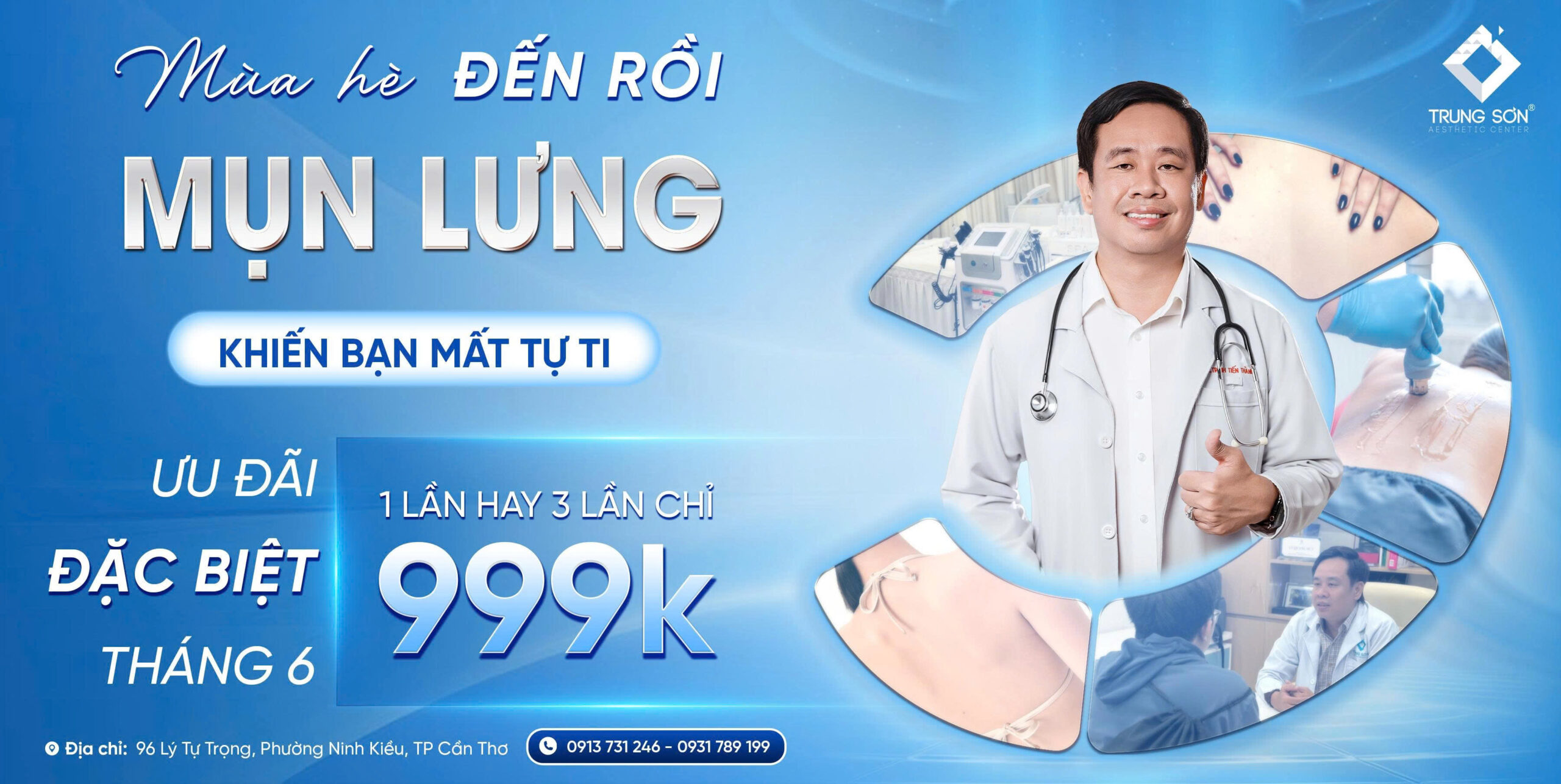 Mụn lưng mùa hè khiến mất tự tin khi mặc áo hở lưng điều trị mụn lưng tại Thẩm Mỹ Trung Sơn Cần Thơ