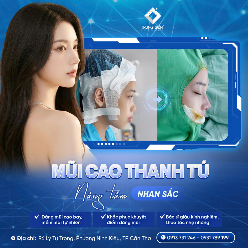 Nâng mũi cấu trúc cao thanh tú giúp khắc phục khuyết điểm dáng mũi, tạo sống mũi cao tự nhiên tại Thẩm mỹ Trung Sơn Cần Thơ.