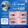 Cắt mí mini tại Thẩm mỹ Trung Sơn Cần Thơ giúp tạo mắt hai mí tự nhiên, ít xâm lấn, hồi phục nhanh, bác sĩ chuyên khoa trực tiếp thực hiện với chi phí chỉ từ 4.900K.