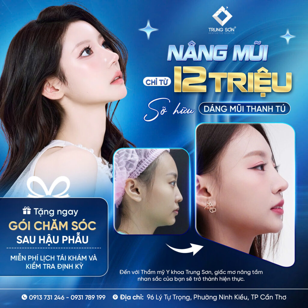 Nâng mũi 12 triệu tại Thẩm mỹ Trung Sơn Cần Thơ