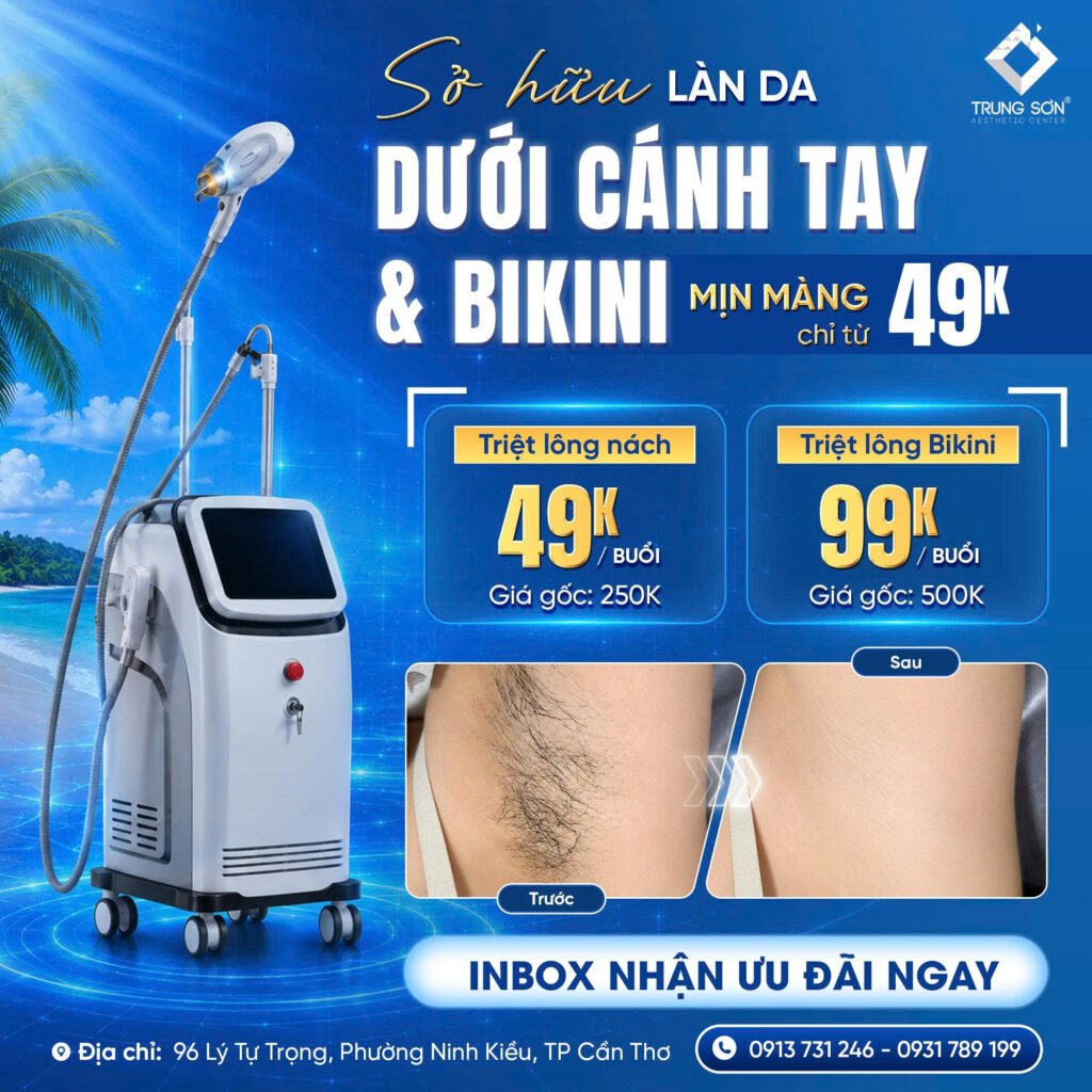 Chương trình triệt lông Cần Thơ tại Trung Sơn với ưu đãi triệt lông nách 49K/buổi và bikini 99K/buổi, hỗ trợ chăm sóc làn da mịn màng