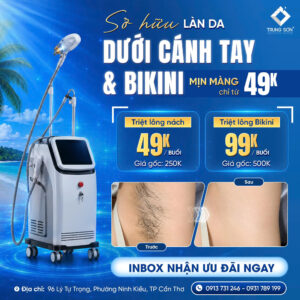 Chương trình triệt lông Cần Thơ tại Trung Sơn với ưu đãi triệt lông nách 49K/buổi và bikini 99K/buổi, hỗ trợ chăm sóc làn da mịn màng